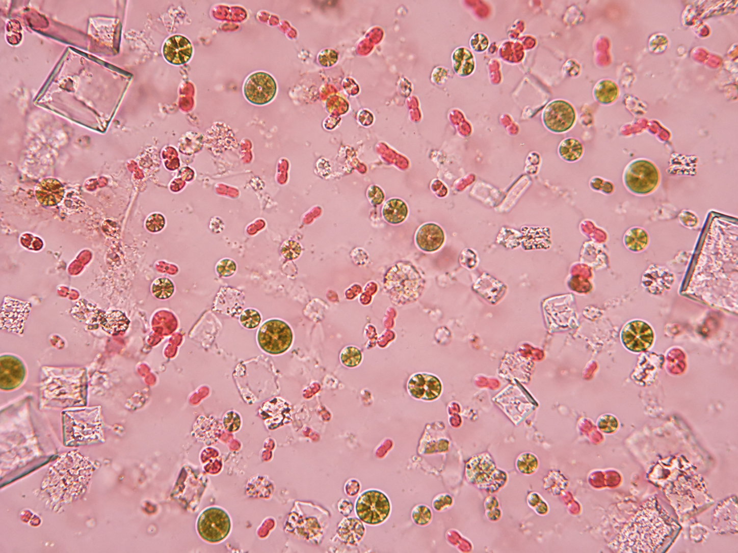 Salt-loving bacteria and algae with natural pigments live in Lake Hillier’s highly saline water.